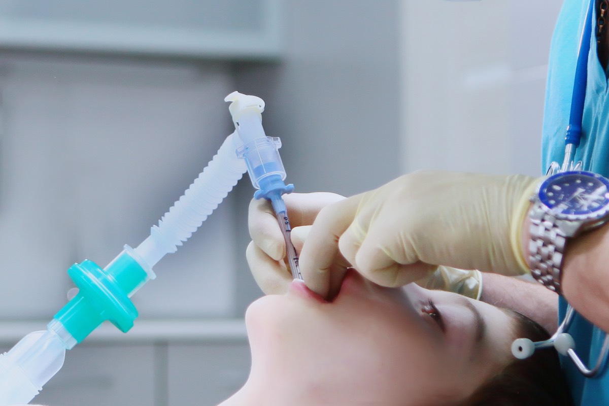 Inhalational Anesthesia in Patients with Irritable Airways